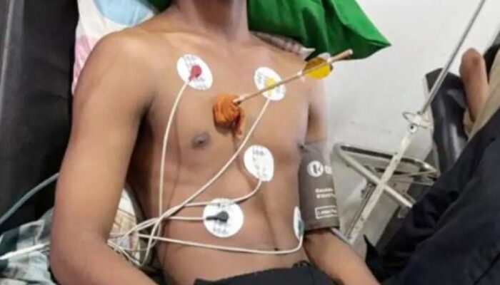 Konflik Warga Danar Picu Korban Jiwa